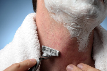 Prevent Pimples After Shaving